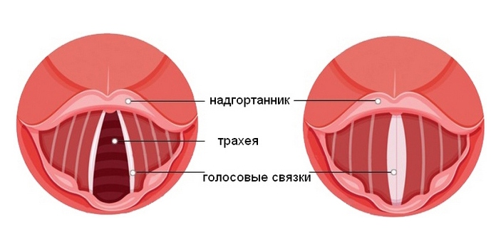 Схема строения голосовых связок