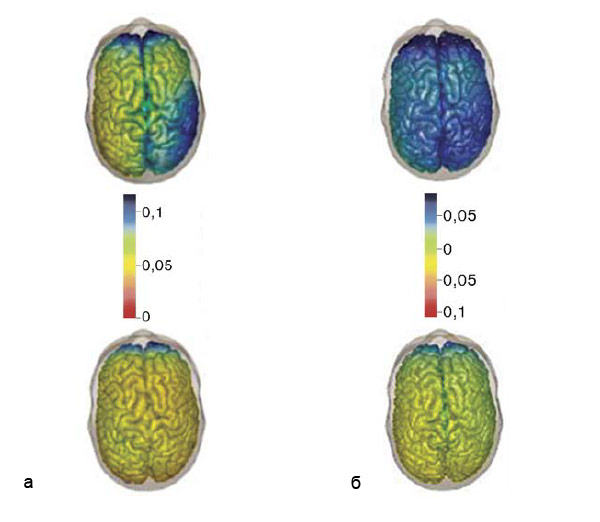 a. У более креативных испытуемых (вверху) выше мощность альфа-ритма в правой затылочной области, чем у менее креативных испытуемых (внизу). Шкала отображает величину мощности альфа-ритма. б. Творческая задача — придумывание альтернативного использования предметов (вверху) сопровождается большей мощностью альфа-ритма, чем контрольная задача — описание свойств предметов (внизу). Шкала отображает величину мощности альфа-ритма. Изображение: «Химия и жизнь»
